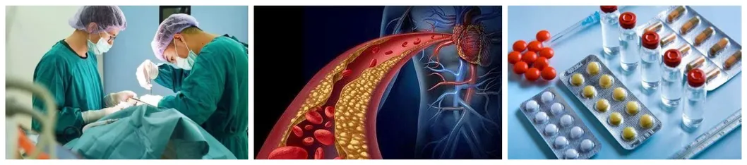 Corydalis Extract Corydalis Root Extract 98% L-Tetrahydropalmatine Thp Powder