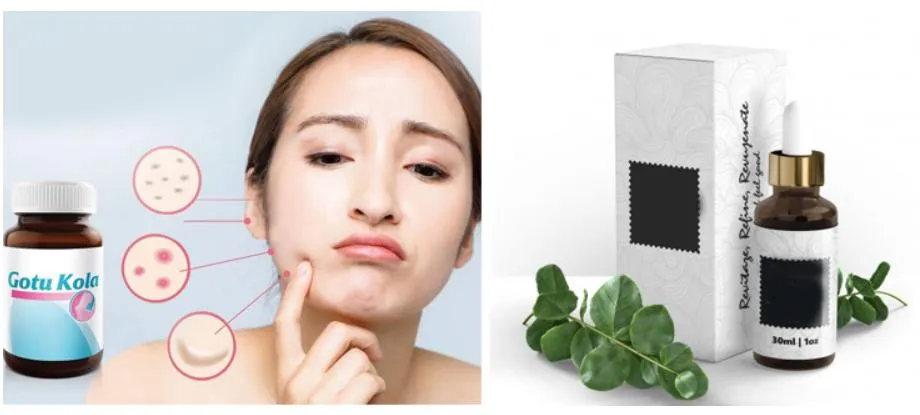 Triterpenoid Glycosides Powder Hydrocotyle Asiatica Extract/Centella Asiatica Extract /Gotu Kola Extract Centella Asiatica